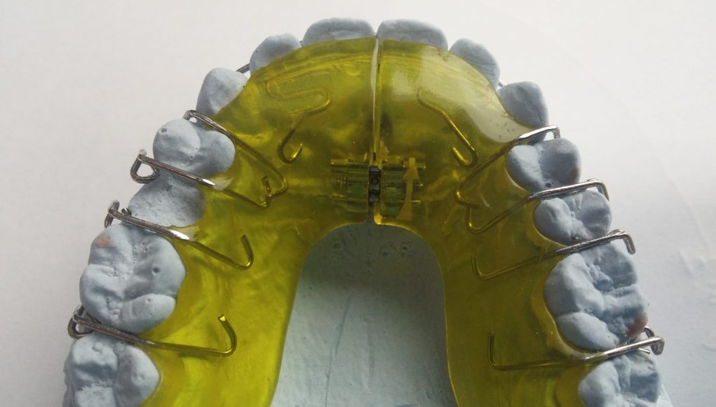 aparat-dentar-ieftin