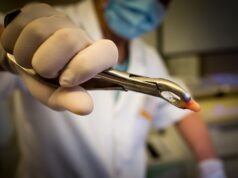 3 motive pentru care sa optezi pentru o extractie masea de minte extractie masea de minte Colentina