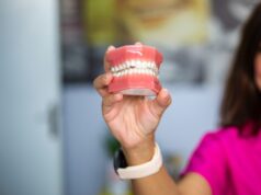 De ce să îți pui coroane dentare: beneficiile și importanța acestui tratament stomatologic Dentist 13 septembrie