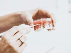 Implant dentar: solutie moderna si de incredere pentru un zambet impecabil plazadent.ro