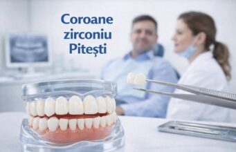 Coroane zirconiu: când sunt indicate și ce avantaje oferă în reabilitarea dentară Cabinet stomatologic Pitesti