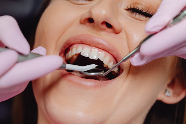 realizarea-fațetelor-dentare Fațetele dentare