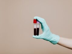Fibrinogenul: ce este, ce rol are în coagularea sângelui și ce indică analiza Fibrinogenul