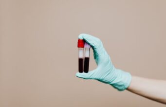 Fibrinogenul: ce este, ce rol are în coagularea sângelui și ce indică analiza Fibrinogenul