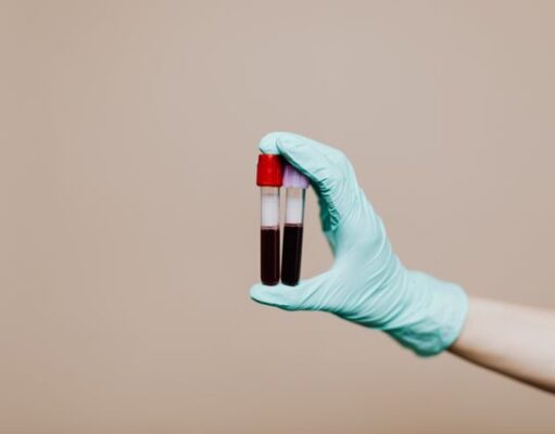 Fibrinogenul: ce este, ce rol are în coagularea sângelui și ce indică analiza Fibrinogenul